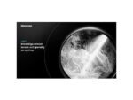 HISENSE WF5I1045BBQ - Wasmachine voorlader - 10.5 kg - 1400 rpm - 72 dB - automatisch doseren - Afbeelding 10